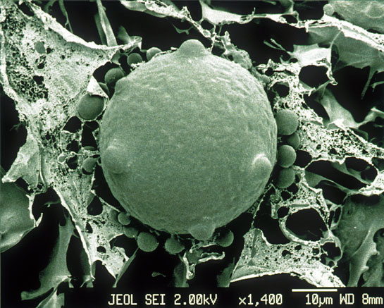 A scanning electron micrograph of a frozen intact zoospore and sporangia of the chytrid fungus (above), which has caused the extinction of more than 200 species of amphibians across the globe.