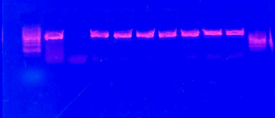 Fluorescently marked DNA bands show up in the gel under the UV light post amplication  using the PCR technique for DNA sequencing.